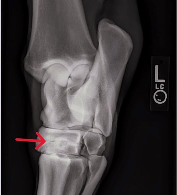 This radiograph shows the fusion of the distal intertarsal joint in a horse's hock.